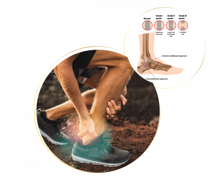 Foot & Ankle Injuries Mark Trezia, DPM